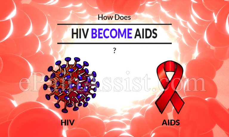 How Does HIV Become AIDS & What are the Treatments for HIV and AIDS