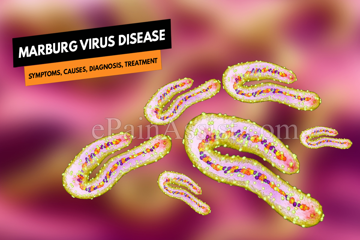 What is Marburg Virus and MVD?