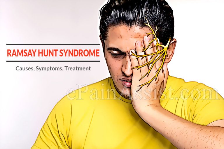 What is Ramsay Hunt Syndrome: Causes, Symptoms, Treatment