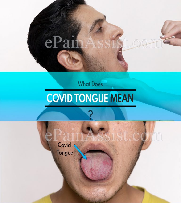 What Does Covid Tongue Mean & How is it Treated?