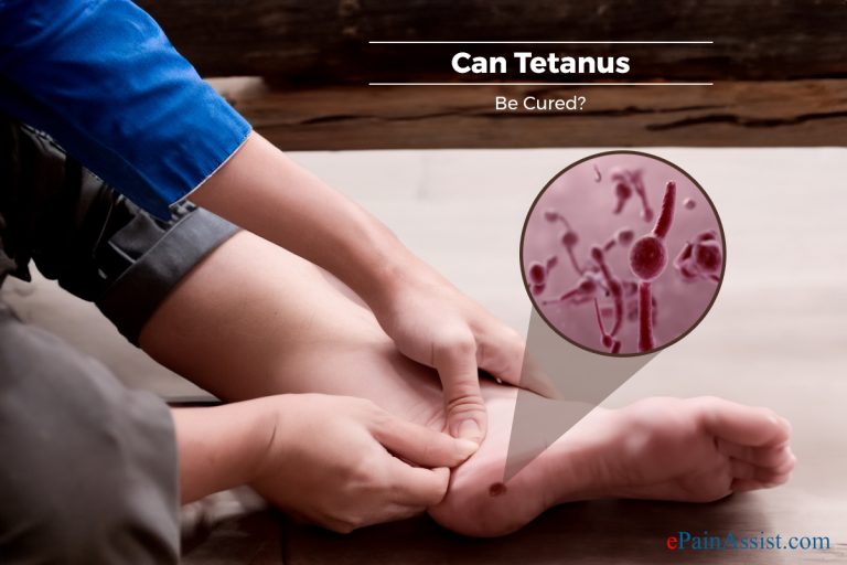 Can Tetanus Be Cured?