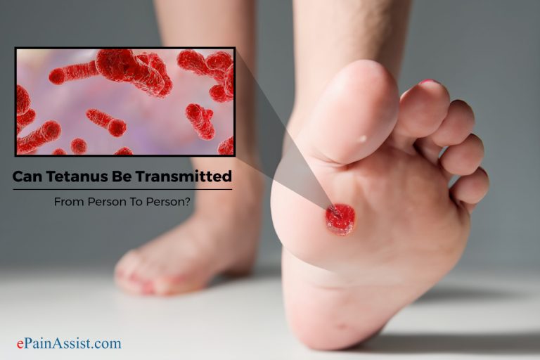 Can Tetanus Be Transmitted From Person To Person?