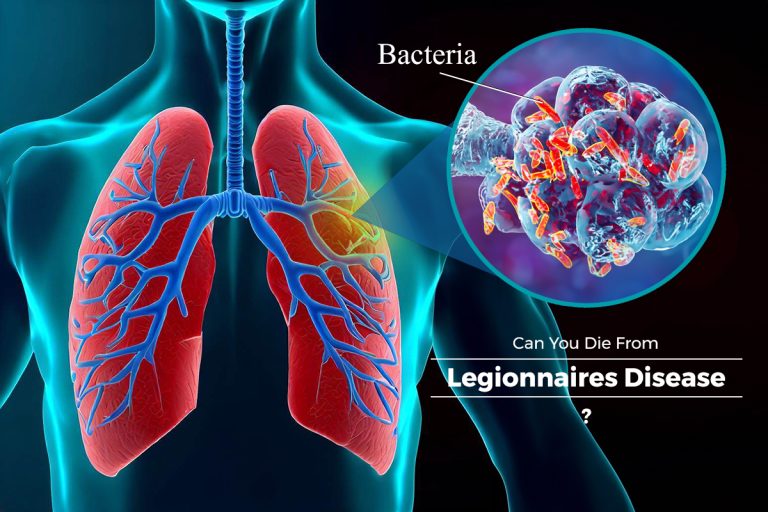 Can You Die From Legionnaires Disease?