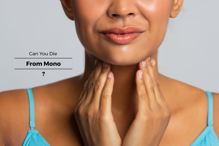 Can You Die From Mono?