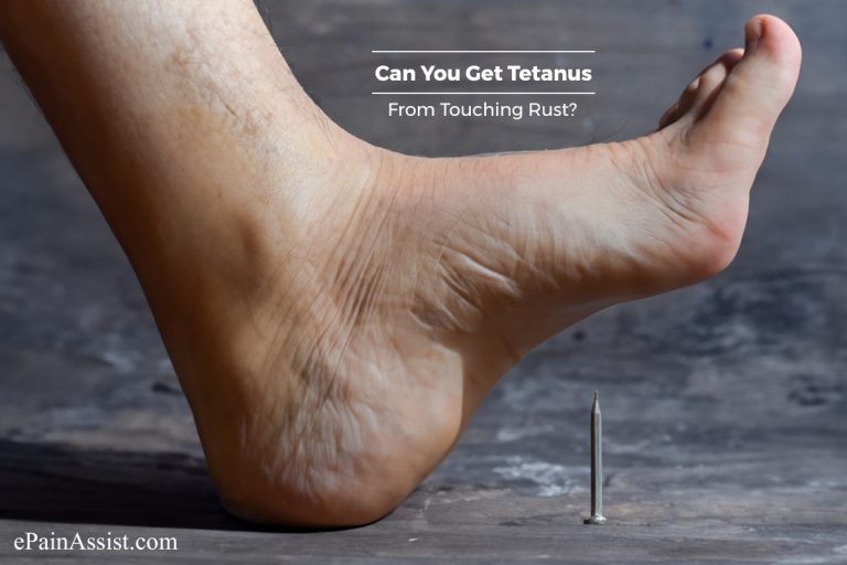 Can You Get Tetanus From Touching Rust?