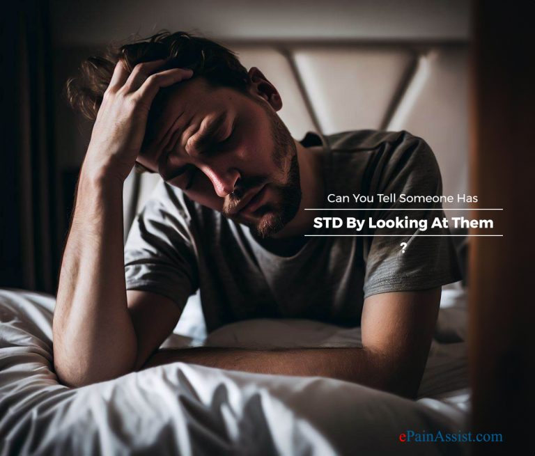 Can You Tell Someone Has STD By Looking At Them?