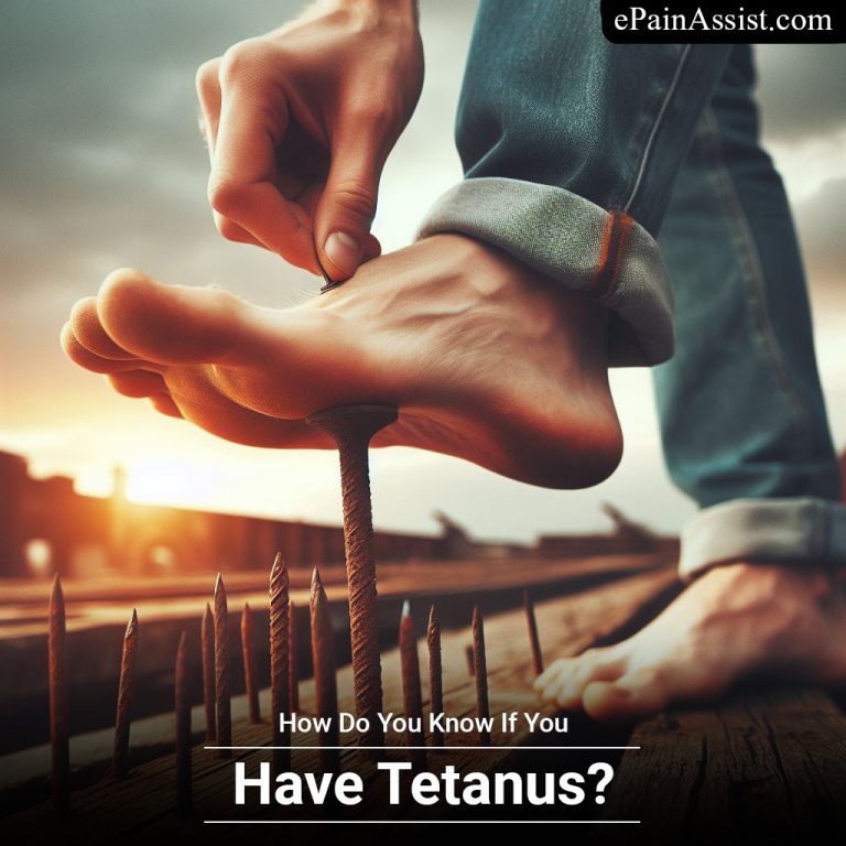 How Do You Know If You Have Tetanus?