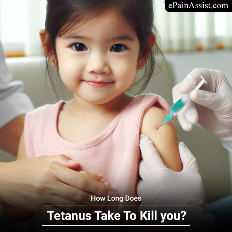 How Long Does Tetanus Take To Kill you?