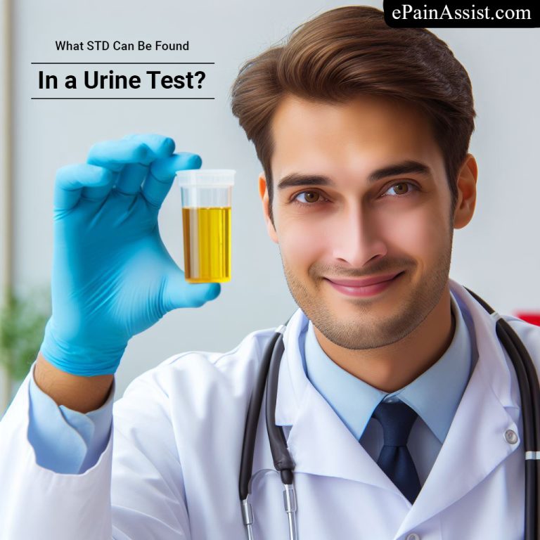What STD Can Be Found In a Urine Test?