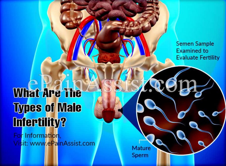 What Are The Types Of Male Infertility?