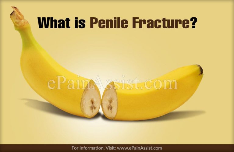 What is Penile Fracture: Causes, Symptoms, Treatment, Diagnosis
