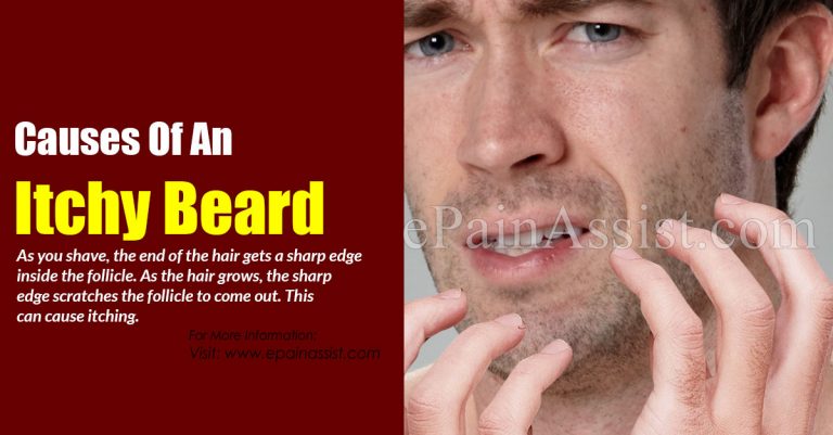 Itchy Beard: Causes & Remedies