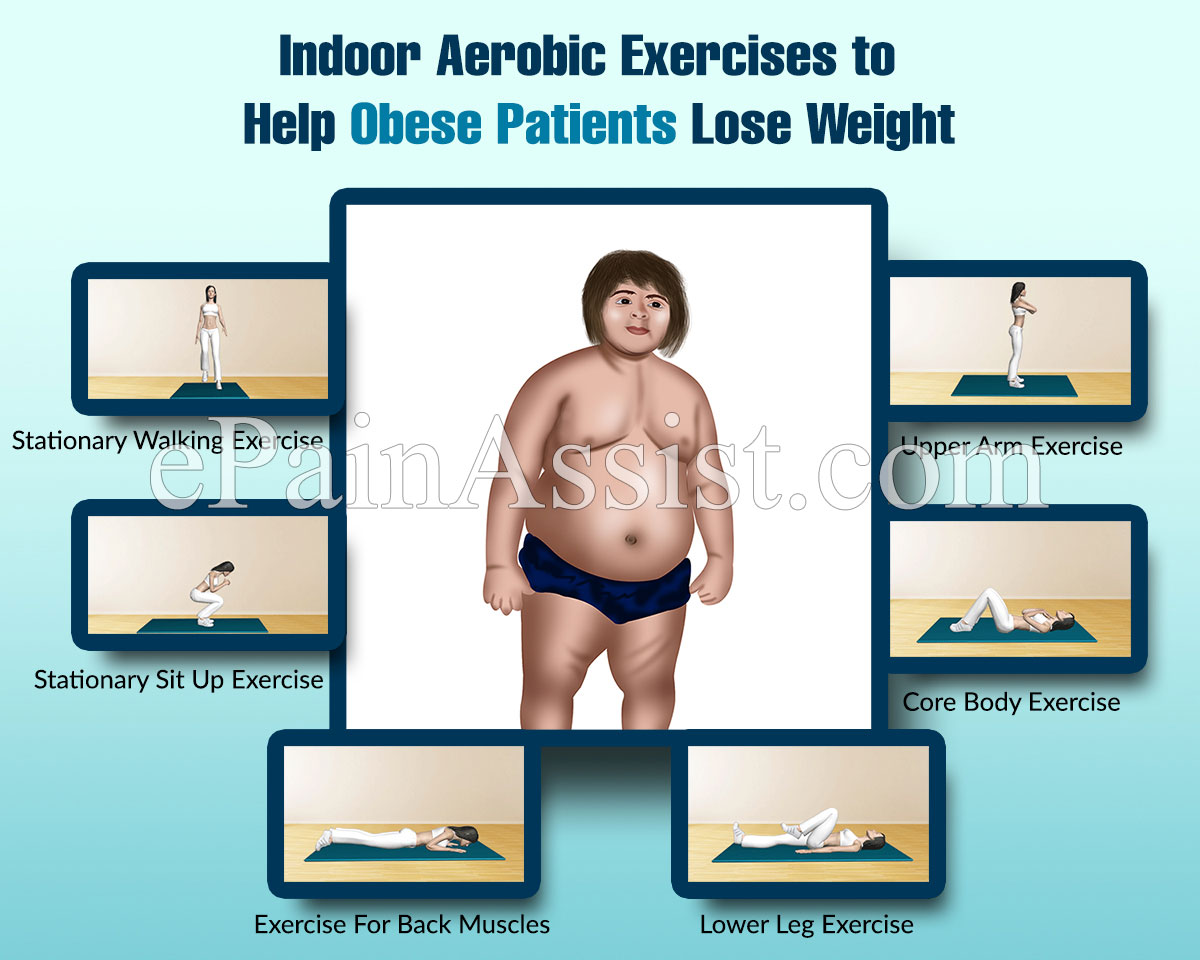 Obesity: Indoor Aerobic Exercises to Help Obese Patients Lose Weight, Exercise Guide