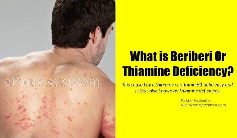 What is Beriberi or Thiamine Deficiency: Causes, Symptoms, Treatment, Home Remedies, Prognosis, Prevention