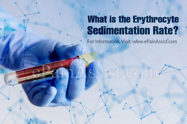 What is Erythrocyte Sedimentation Rate & How is ESR Test Performed?