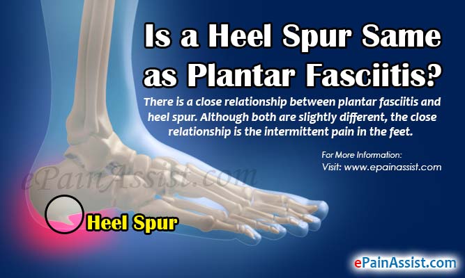 Is a Heel Spur Same as Plantar Fasciitis?