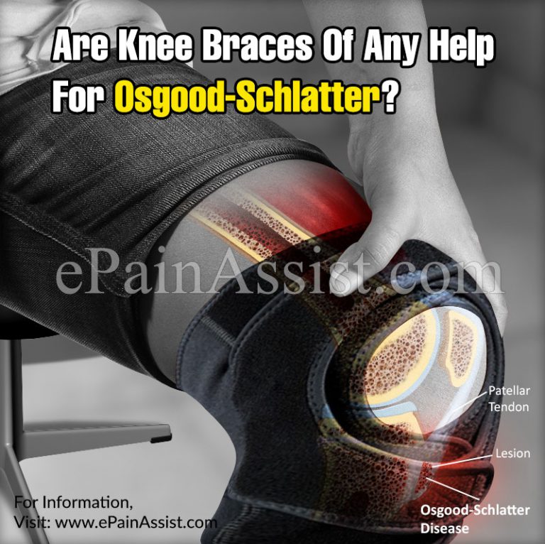 Are Knee Braces Of Any Help For Osgood-Schlatter?