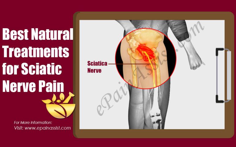 Best Natural Treatments for Sciatic Nerve Pain