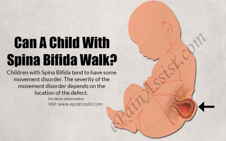 Can A Child With Spina Bifida Walk?