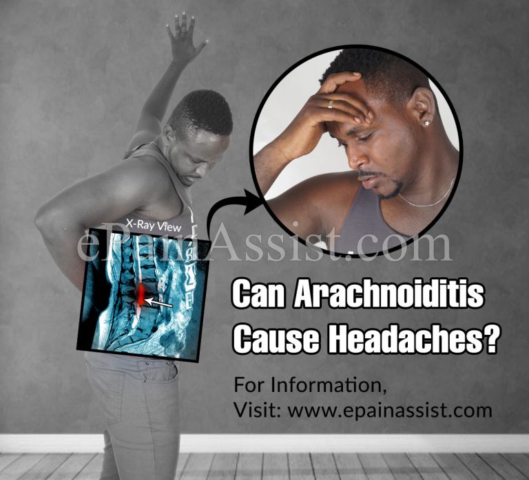 Can Arachnoiditis Cause Headaches?