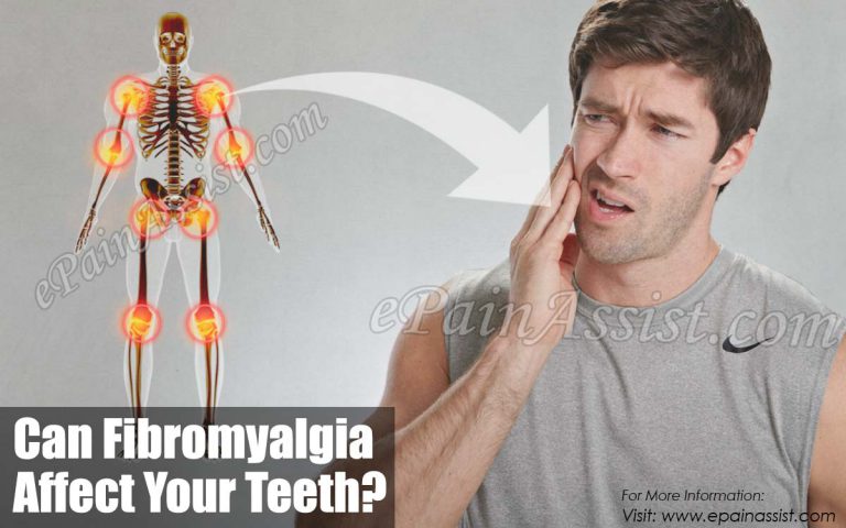 Can Fibromyalgia Affect Your Teeth?