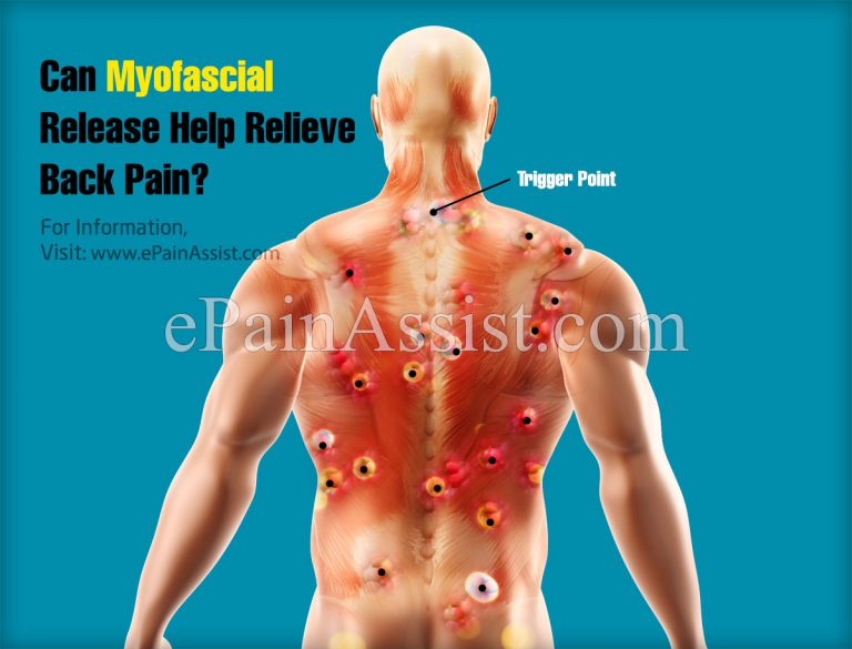 Can Myofascial Release Help Relieve Back Pain?