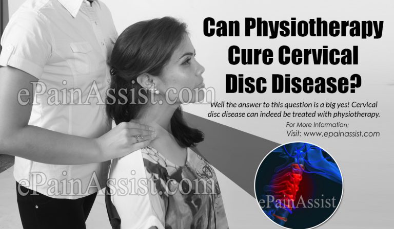 Can Physiotherapy Cure Cervical Disc Disease?