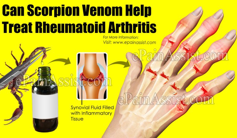 Can Scorpion Venom Help Treat Rheumatoid Arthritis?