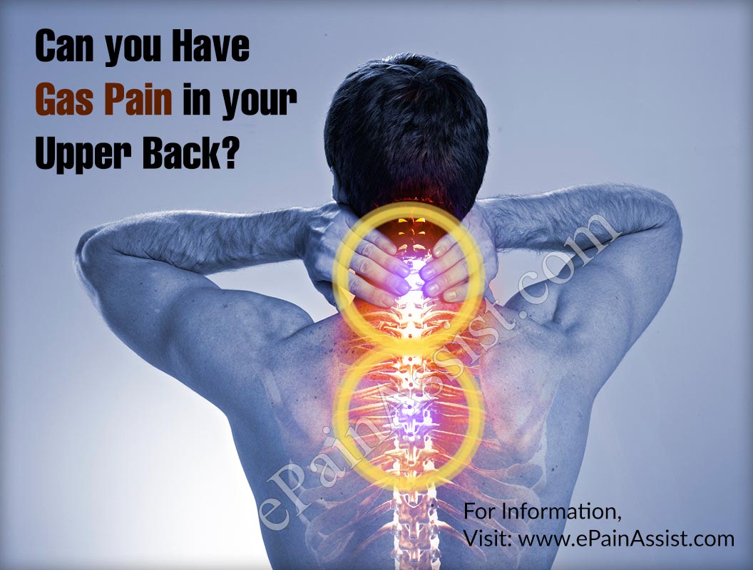 Can You Have Gas Pain In Your Upper Back?