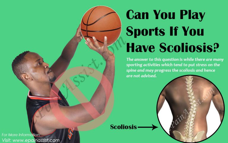 Can You Play Sports If You Have Scoliosis?