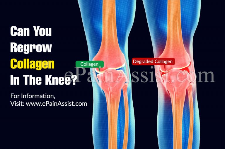 Can You Regrow Collagen In The Knee?