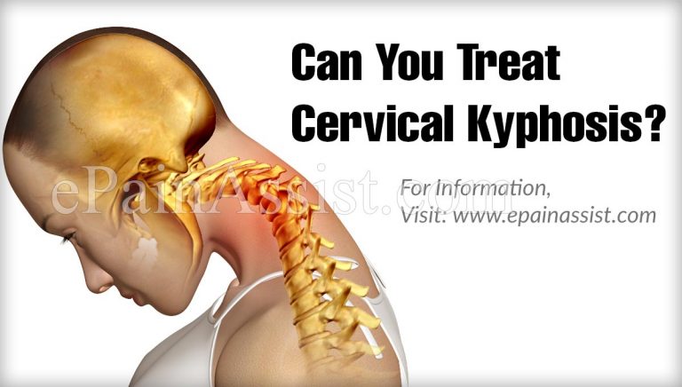 Can You Treat Cervical Kyphosis?