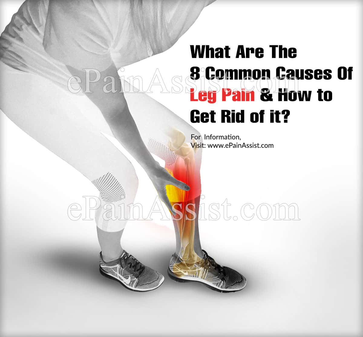 What Are The 8 Common Causes Of Leg Pain & How Can I Get Rid Of It?