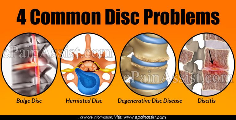 4 Common Disc Problems :  Disc Bulge, Herniated Disc, DDD, Discitis