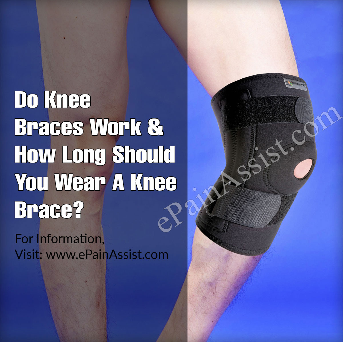 Do Knee Braces Work & How Long Should You Wear A Knee Brace?