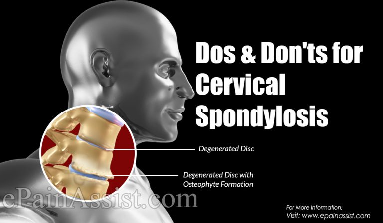 Dos & Don’ts for Cervical Spondylosis