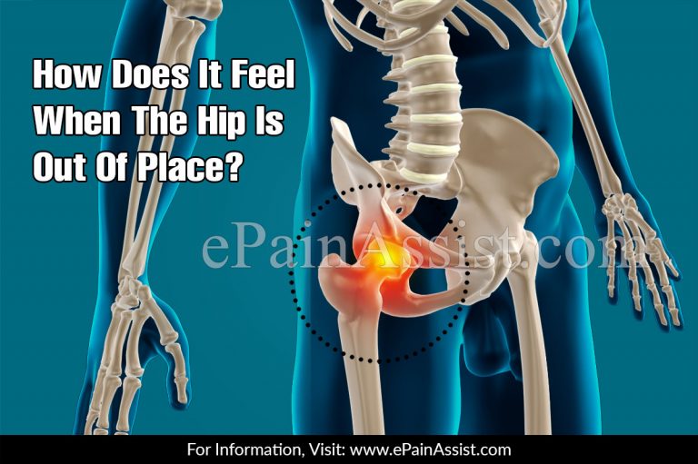 How Does It Feel When The Hip Is Out Of Place?