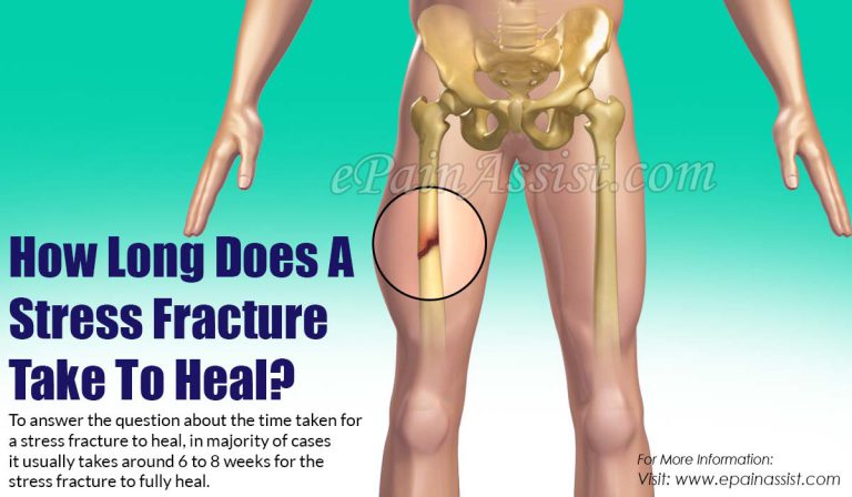 How Long Does A Stress Fracture Take To Heal?