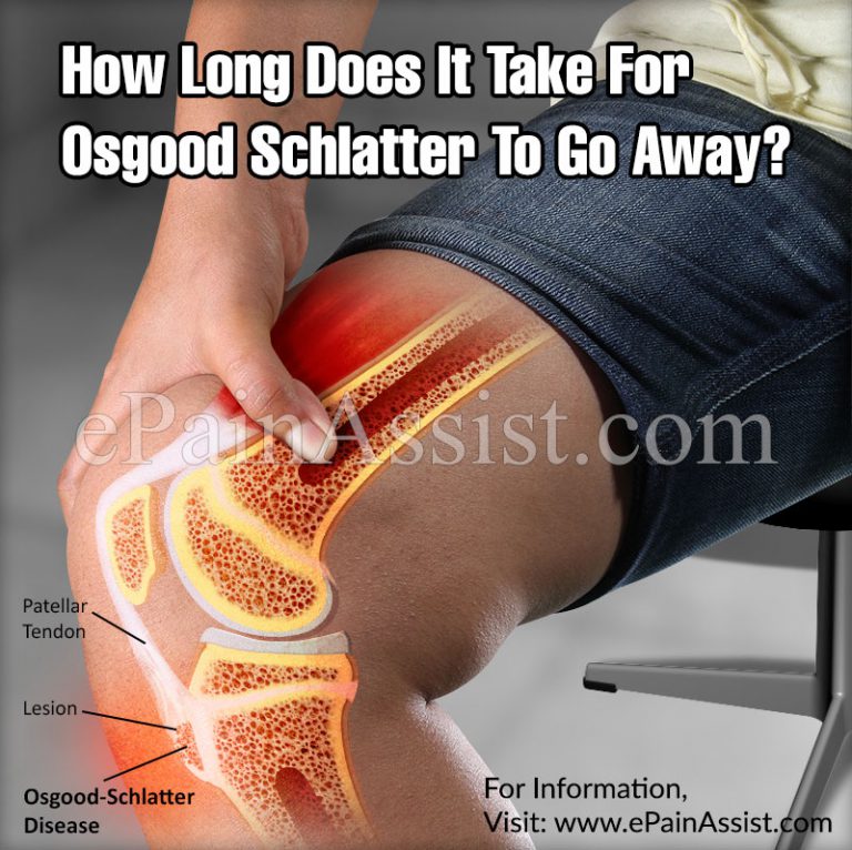How Long Does It Take For Osgood Schlatter To Go Away?