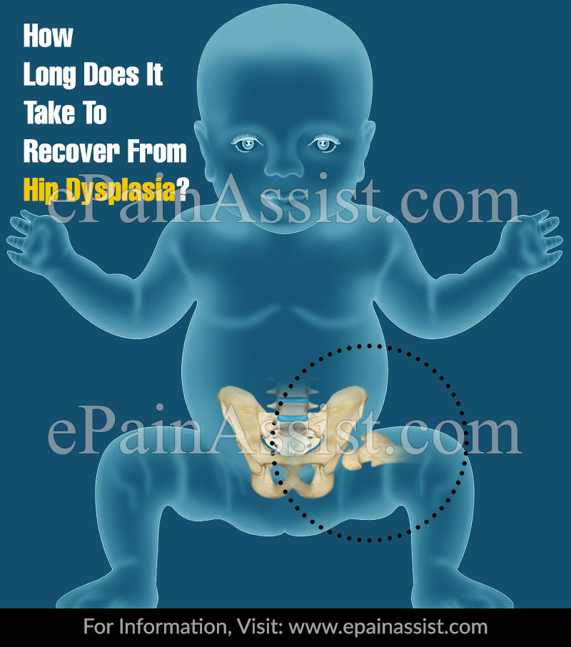 How Long Does It Take To Recover From Hip Dysplasia?