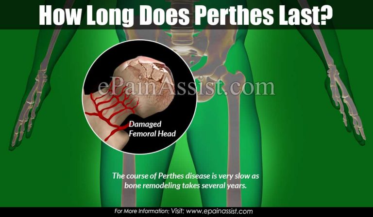 How Long Does Perthes Last?