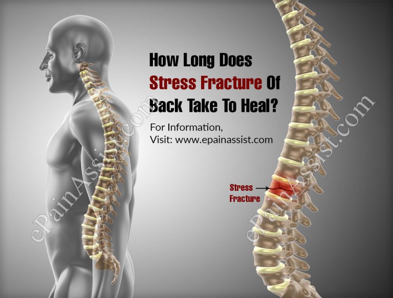 How Long Does Stress Fracture Of Back Take To Heal?