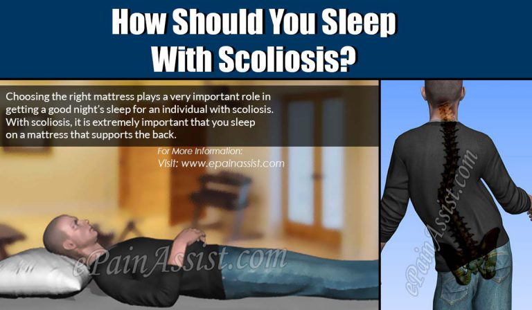 How Should You Sleep With Scoliosis?