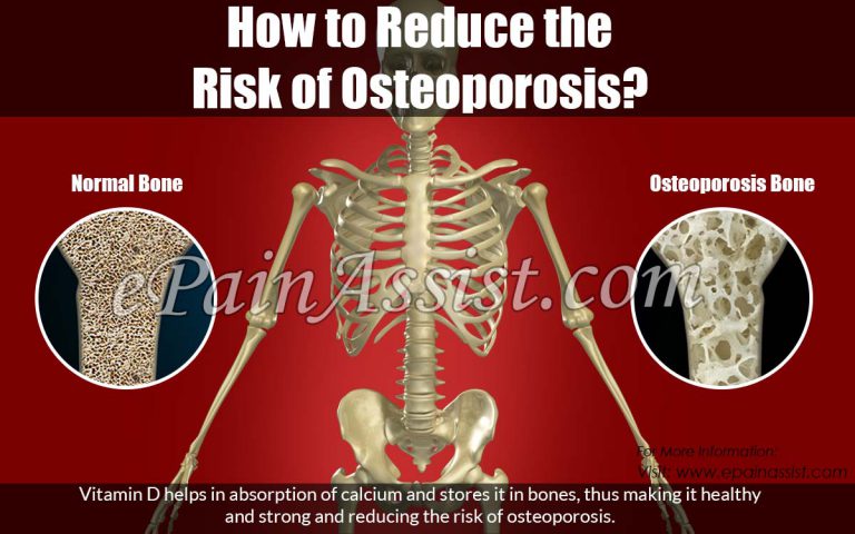 How to Reduce the Risk of Osteoporosis?