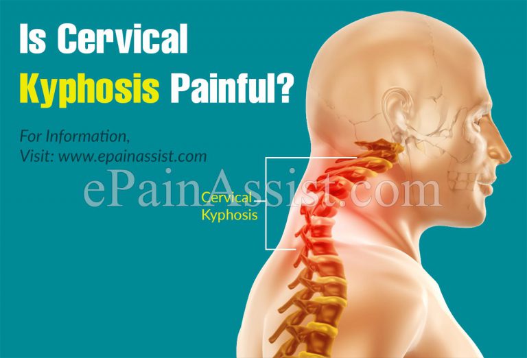 Is Cervical Kyphosis Painful?