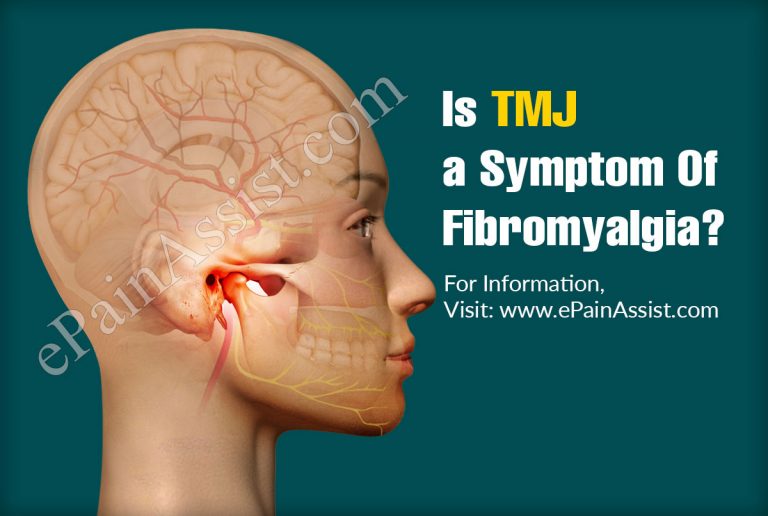 Is TMJ a Symptom Of Fibromyalgia?