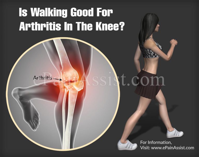 Is Walking Good For Arthritis In The Knee?