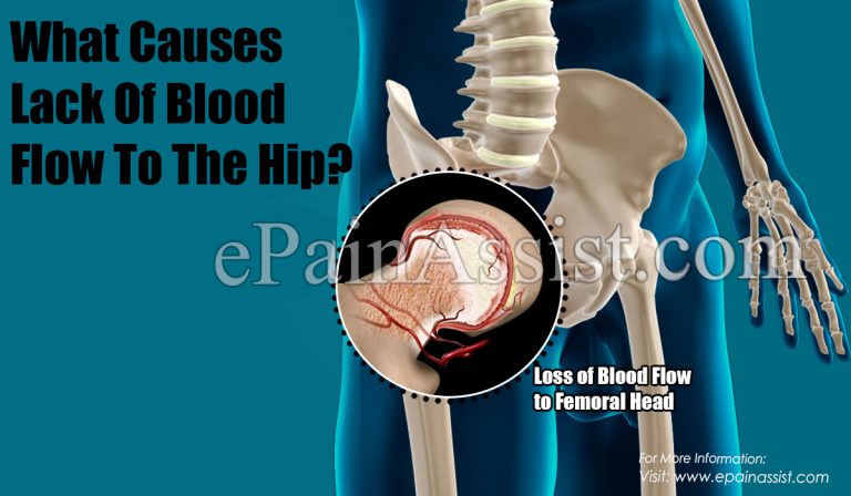 Lack of Blood Flow to the Hip: Consequences & Causes
