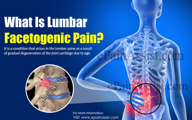 Lumbar Facetogenic Pain: Causes, Symptoms, Treatment