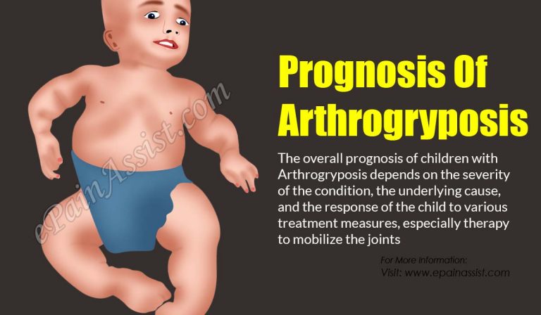 Prognosis Of Arthrogryposis